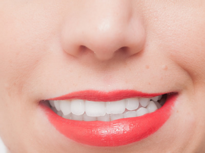 歯の折れ方によって異なる修復法