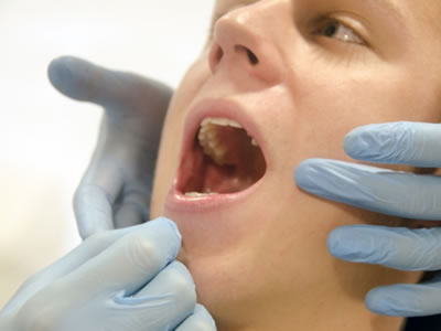 口腔周辺にできる良性腫瘍とは？